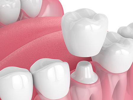 Blue Coral Pediatric Dentistry Orthodontics
