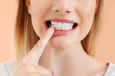 Blue Coral Pediatric Dentistry Orthodontics