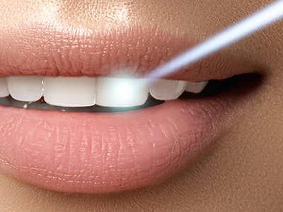 Blue Coral    Pediatric Dentistry   Orthodontics | Root Canals, Botox reg  and VELscope reg  Cancer Screening